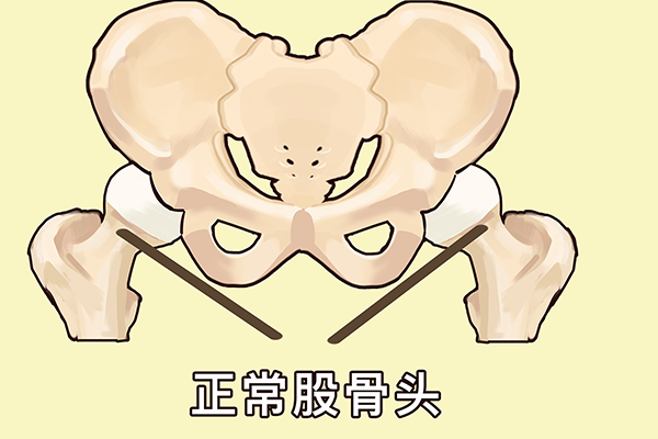 股骨头位置在哪里
