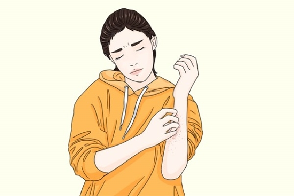 湿疹怎么治疗能除根