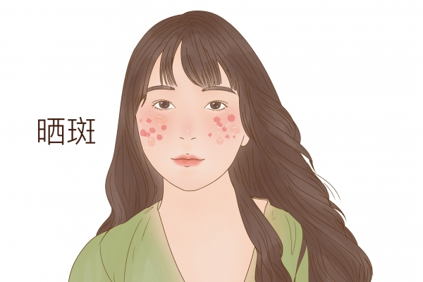 脸上有斑吃维生素C还是E