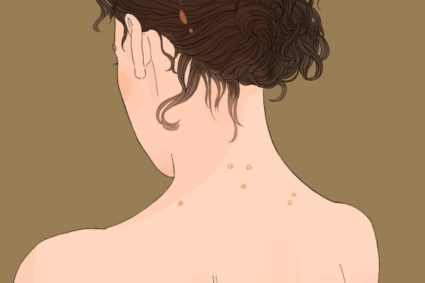 怎样除湿气效果最好