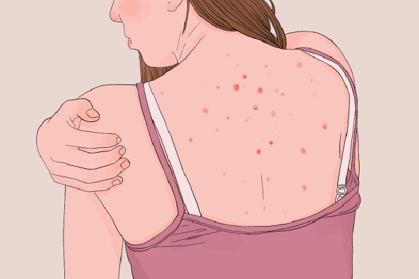 湿气重怎么改善