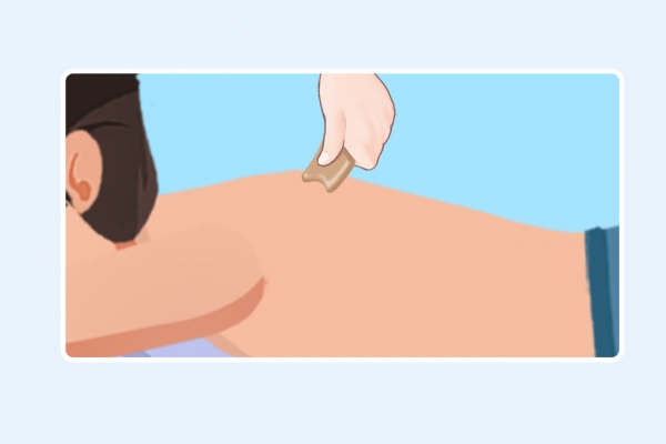 刮痧能去除体内湿气吗